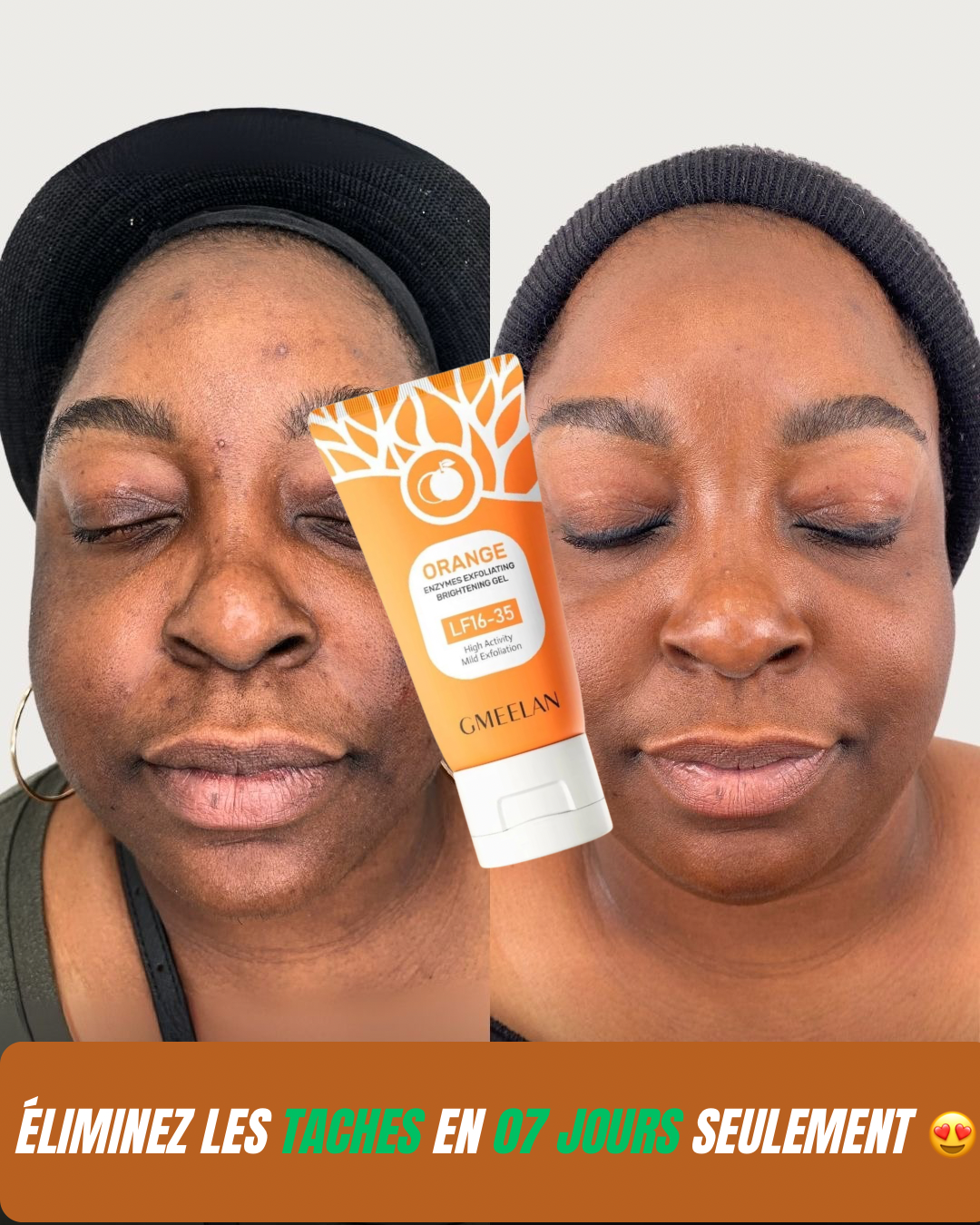 Gel Exfoliant Éclaircissant à l’Orange (LF16-35)