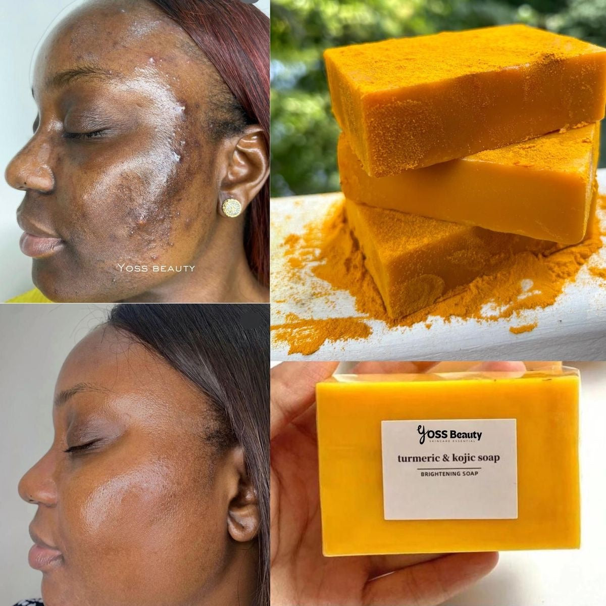 Savon Éclat Naturel – Anti Taches & Acné