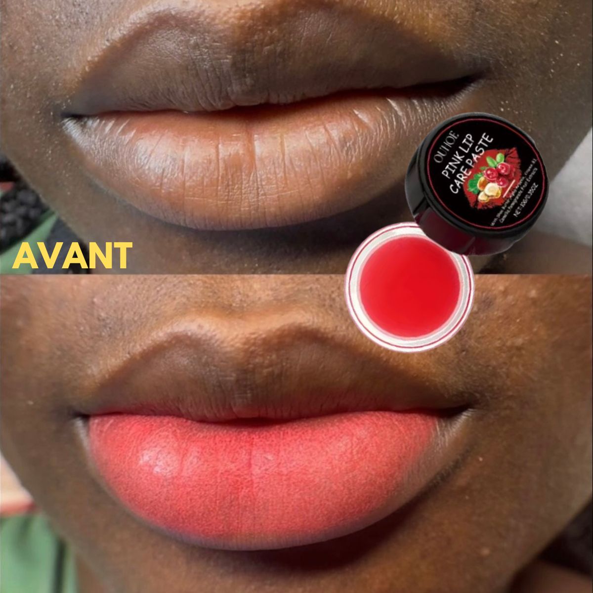 Baume Lèvres Rosées – Élimine les lèvres noircies en douceur 💋